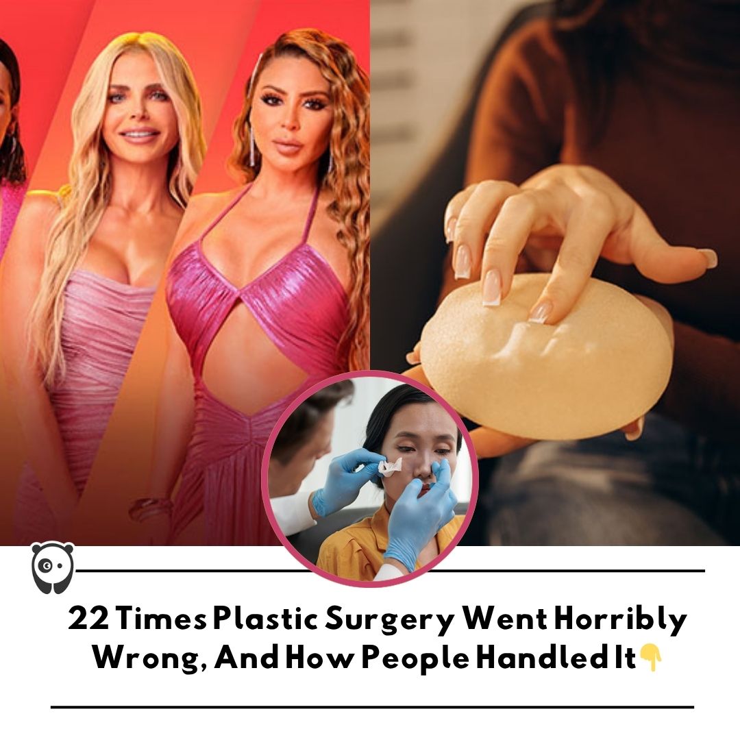 22 times plastic surgery went horribly wrong, and how people handled it. Click link in bio for more!
