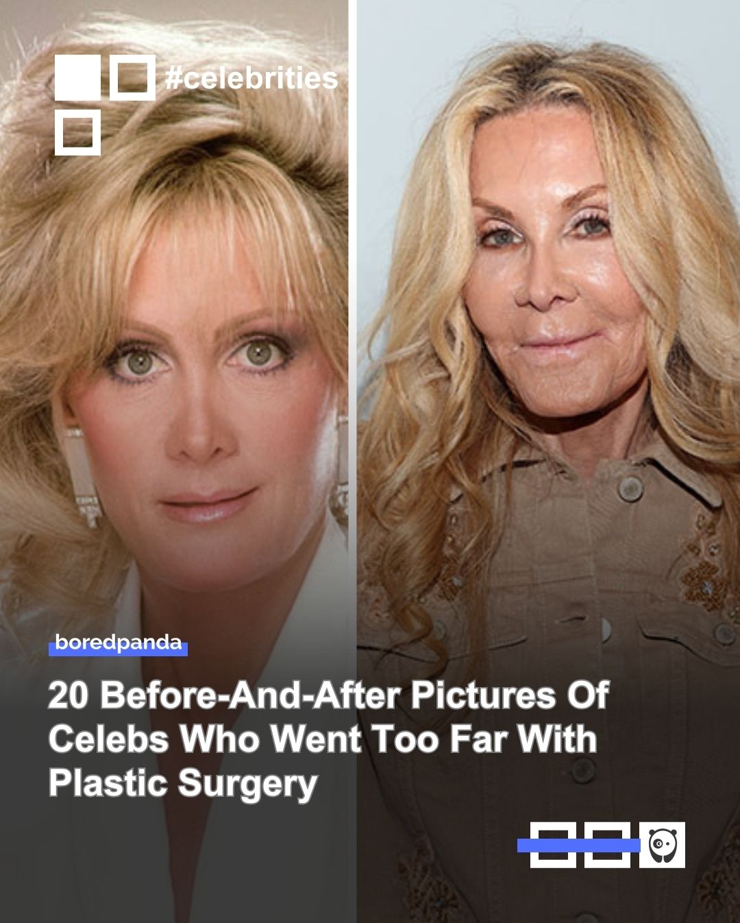 These 20 celebs went under the knife, and the results didn't turn out well. Click link in bio for more!

#celebrities