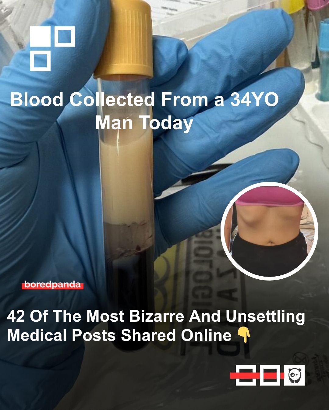42 of the most bizarre and unsettling medical posts shared online. Click link in bio for more!