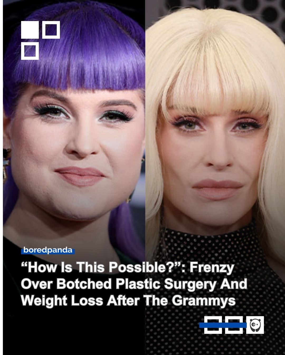 As the #Grammys2026 took place on Sunday, social media erupted with speculation over celebrity surgery rumors. Click link in bio for more!