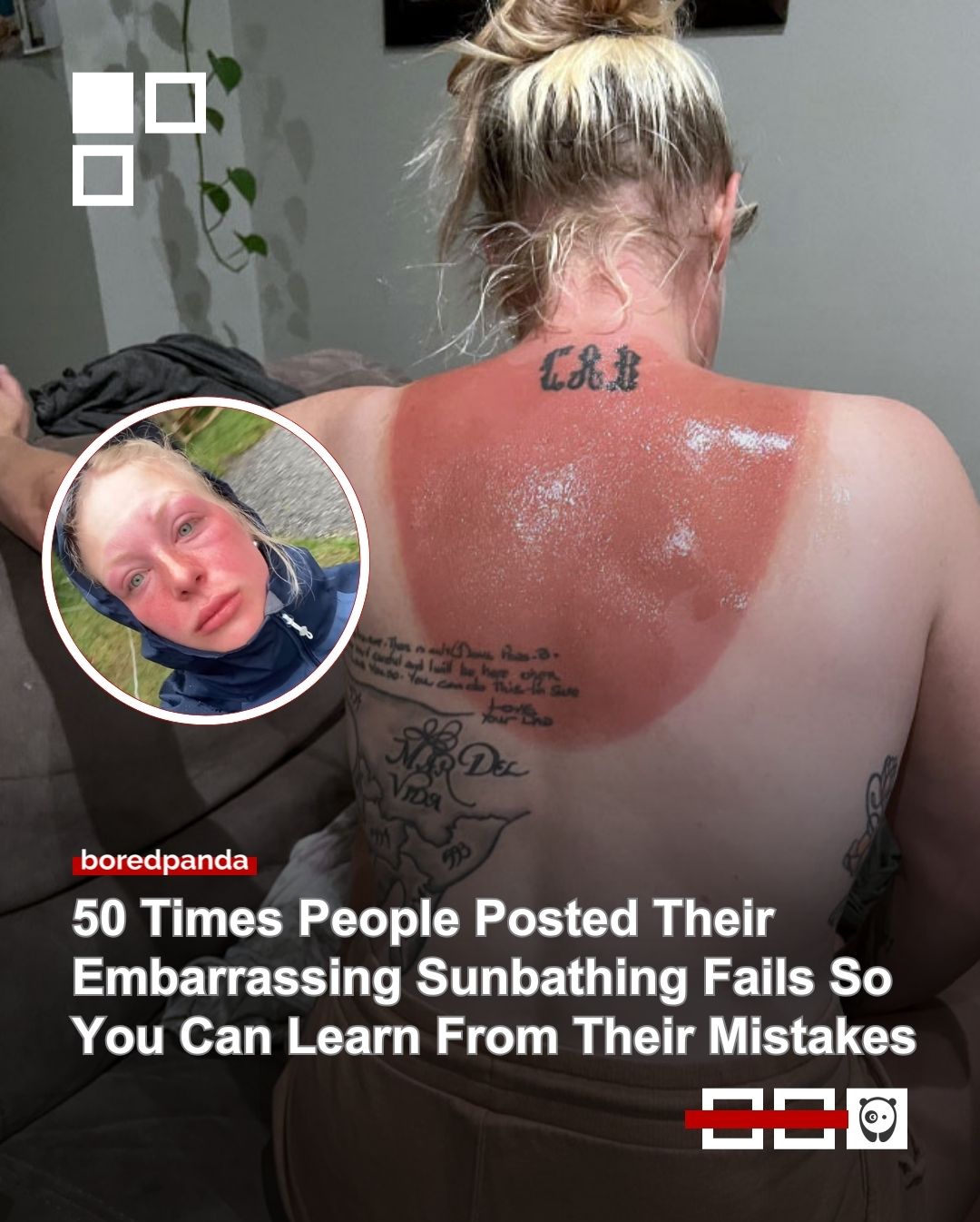 A little sunshine can go a long way—but sometimes it goes way too far. From wildly uneven tan lines to sunburns people definitely didn’t plan for, the internet is full of painful (and slightly hilarious) reminders to wear sunscreen. 

See the thread at the link in our bio.