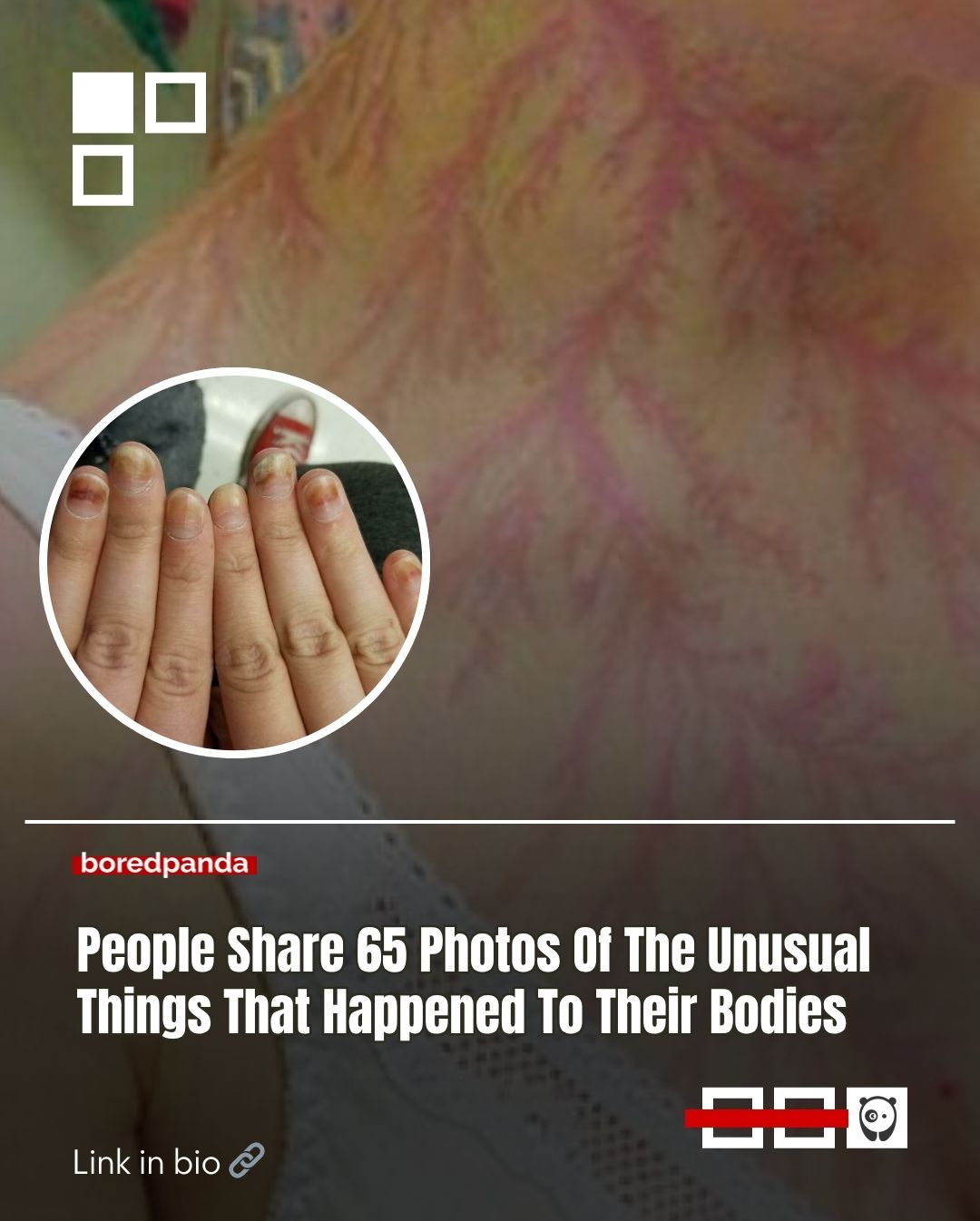 The human body is remarkable. It can perform jaw-dropping feats, like landing a triple Axel, and endure far more than we often realize. 

To celebrate that resilience, we’ve compiled a gallery of people with unusual physical traits. 

See all at the link in our bio!

#body #viral #interesting