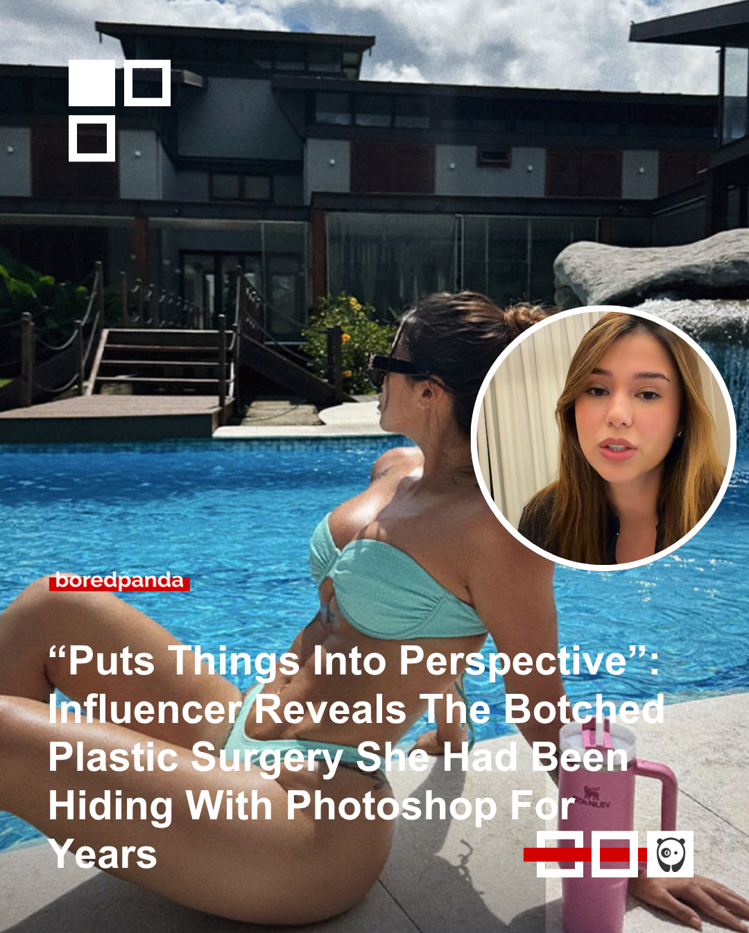 Mariana Tavares admitted to Photoshopping her social media pictures for years after multiple botched procedures. The influencer underwent liposuction on her arms, stomach, and back, as well as breast surgery.
She accused the clinic, JK Estética Avançada, of discouraging her from taking legal action and lying about the expected results.Read more at the link in our bio.