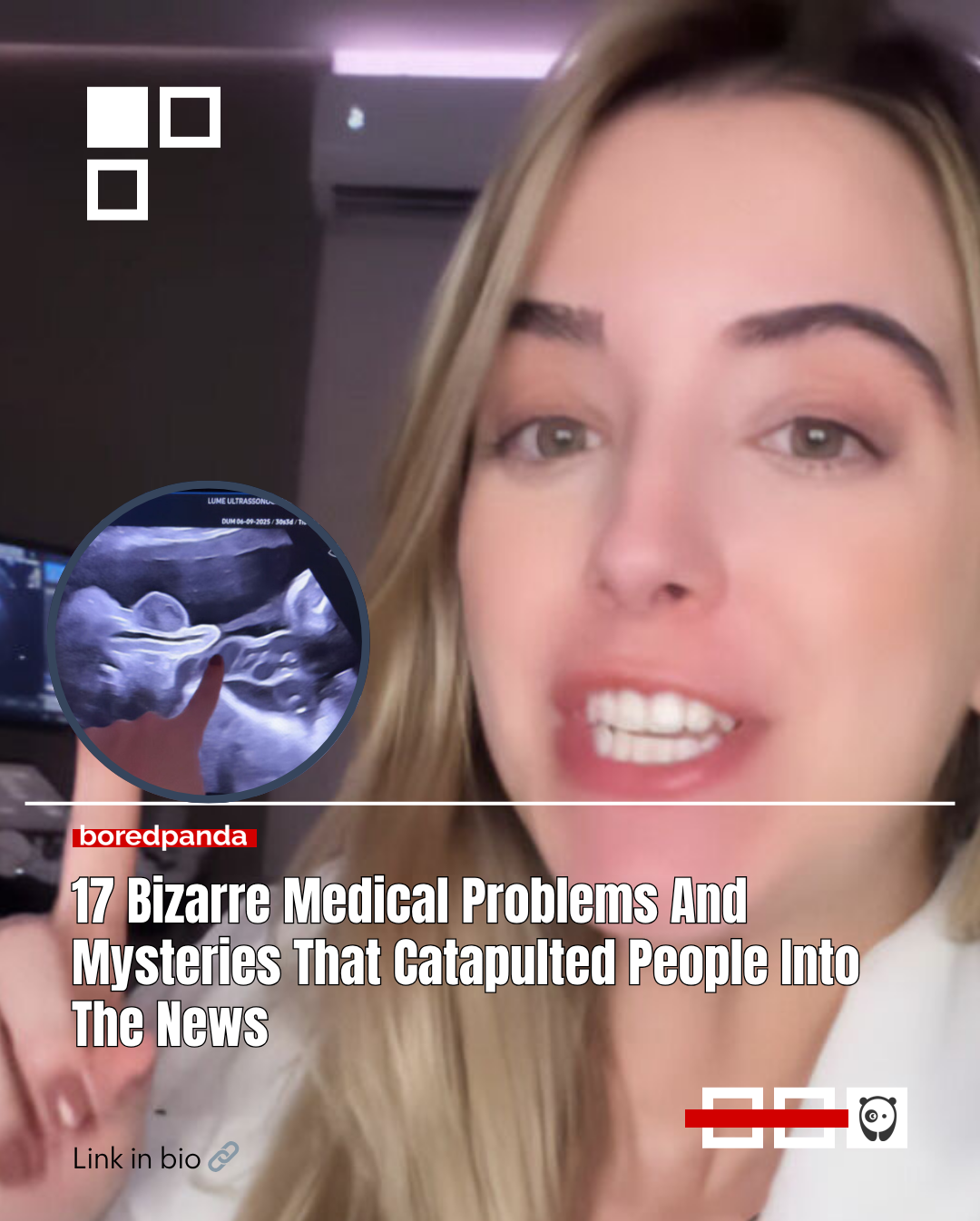 Pregnant doctor Lais Coutinho shared a viral ultrasound video showing her fetus urinating inside the womb.
Fetal urine production starts early and becomes established by 10–12 weeks. Read more at the link in our bio.