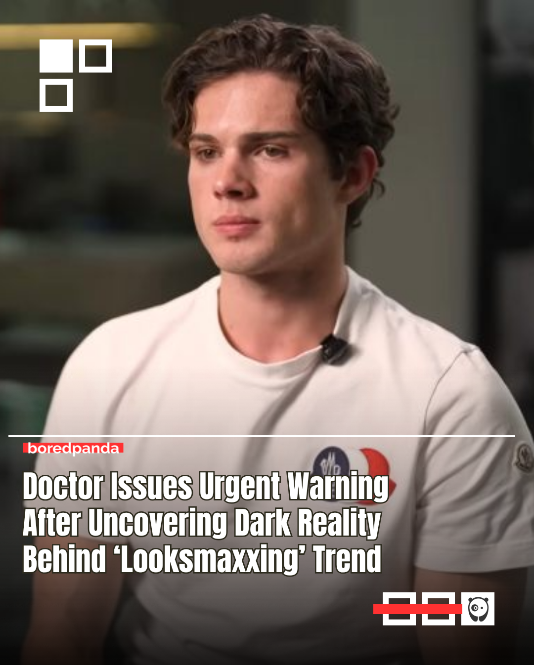 The term “looksmaxxing” has taken the internet by storm, leading to questions about whether it’s just a harmless trend or a serious cause for concern.

Looksmaxxing, the act of optimizing one’s physical attractiveness, has become increasingly popular among young men. 

The most prominent face of the movement is Clavicular, a 20-year-old content creator who was expelled from college and is now known for promoting harmful techniques aimed at enhancing his followers’ appearance.

Adam Taylor, a professor of anatomy at Lancaster University, told Bored Panda that short-term consequences associated with bone-smashing include bruising, loose or knocked out teeth, bleeding gums, and fractured or broken bones.

The trend can also leave long-term consequences, such as nerve damage, scar tissue formation, and changes in biting mechanics.