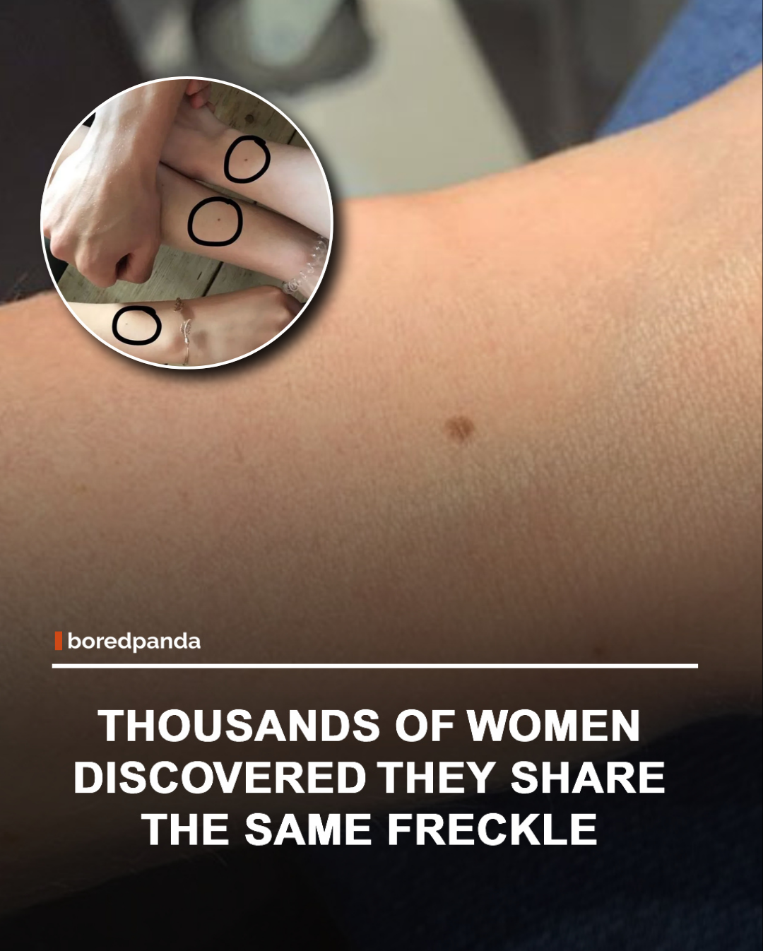 A simple post asking whether women had a tiny freckle in the middle of their wrist quickly turned into a viral internet mystery. Thousands of people began sharing photos, amazed to find they had nearly identical freckles in the same spot. While it might seem like an incredible coincidence, dermatologists say there's a simple explanation: wrists are frequently exposed to sunlight, making them a common place for freckles and small moles to appear. Still, the uncanny similarity was enough to send people rushing to check their own wrists 



Do you have this little freckle too? Show us in the comments! 🤔



#freckles #viral #handfreckle 