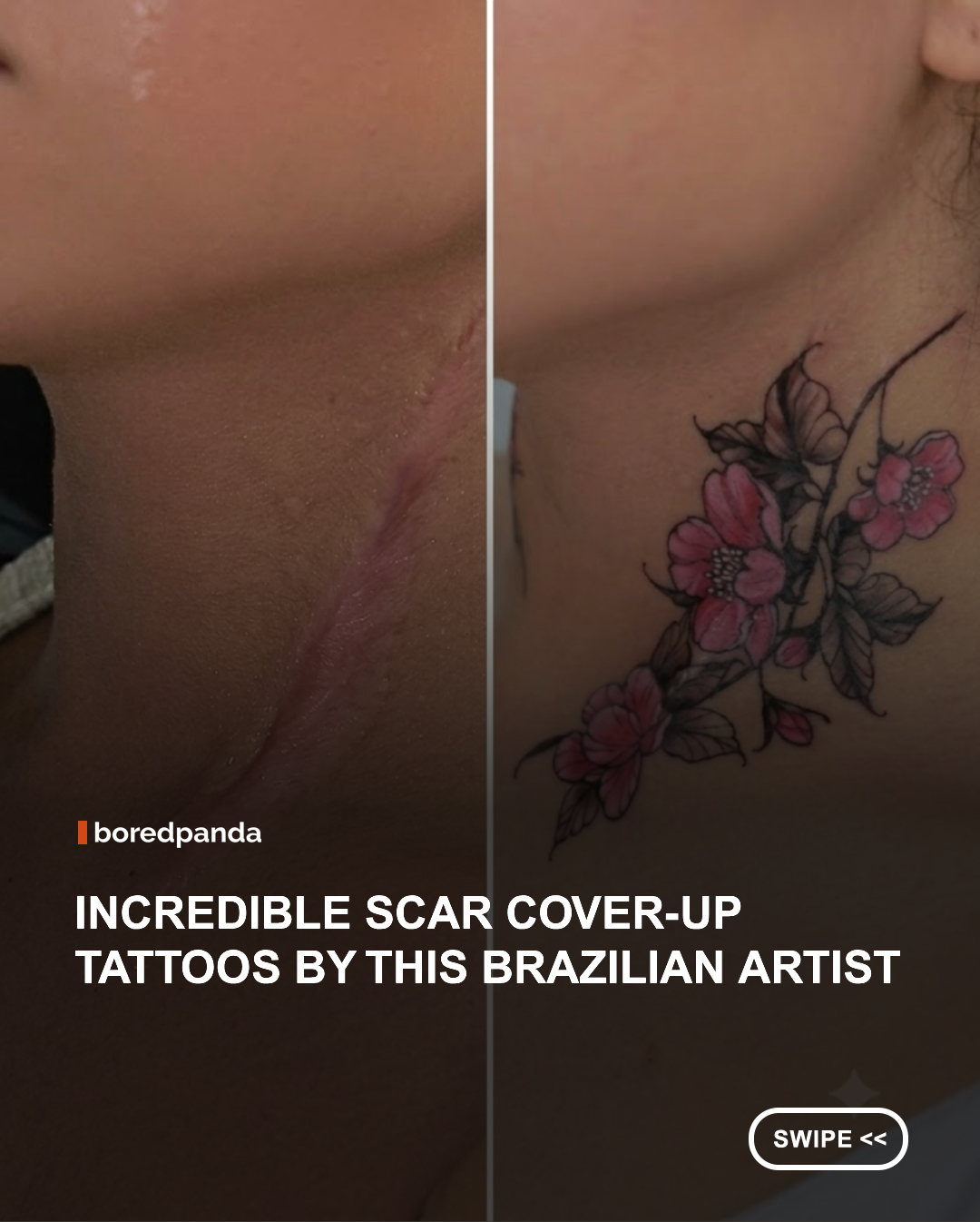 For nearly 20 years, Elvira Bono has worked as a tattoo artist specializing in artistic scar tattoo cover-ups in Brazil. Her background in Nursing and Fine Arts has taught her that every scar tells a story, not only of surgery, burns, accidents, or illness, but also of survival. #tattoo #inspiring #scarstattoos